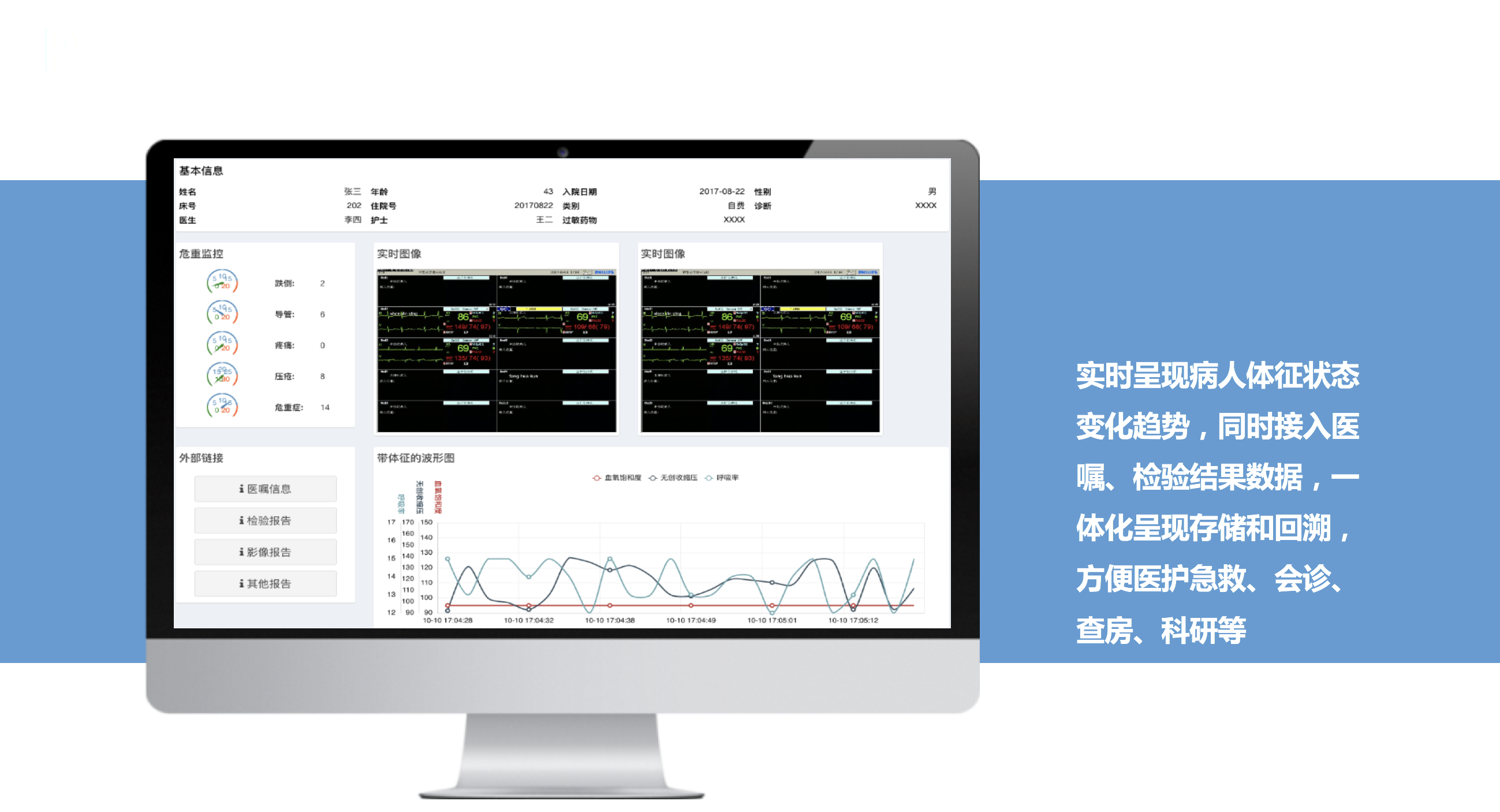 UniVue中央监护系统